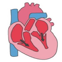 BCM/TCH Cardiomyopathy